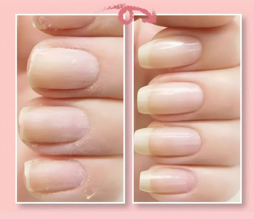 NailRevive™ | Gel de réparation pour ongles fissurés (1+1 GRATUIT)